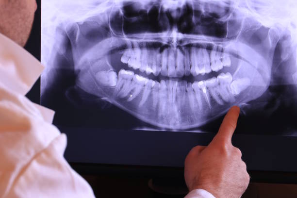 Best Broken Tooth Emergency  in Rushville, NE